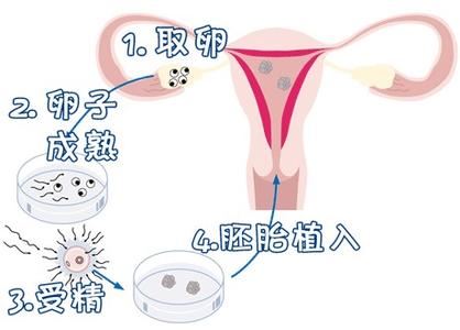 关于拉拉供卵服务微信群